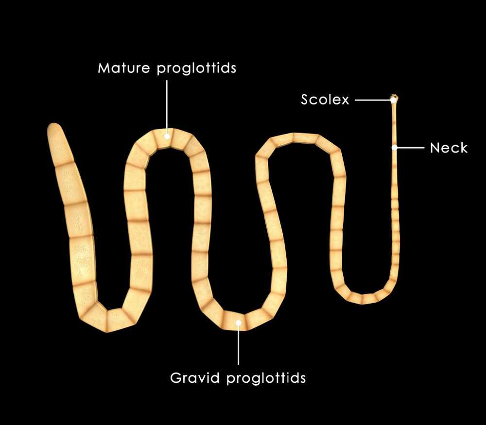 Larva di tenia mortale prelevata dal cervello / Notizie di salute