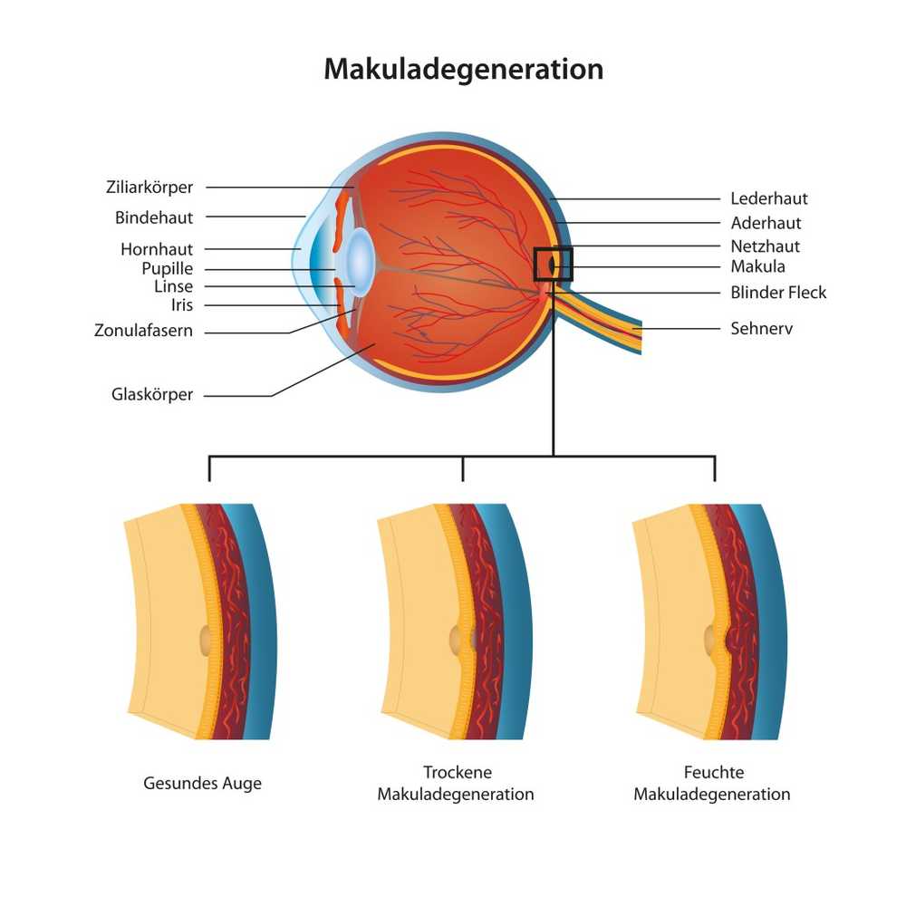 Macular degeneration Age-related blindness can be cured by stem cells in the future / Health News