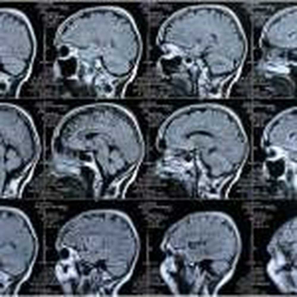 Nobelpriset för Brain Navi / Hälsa nyheter