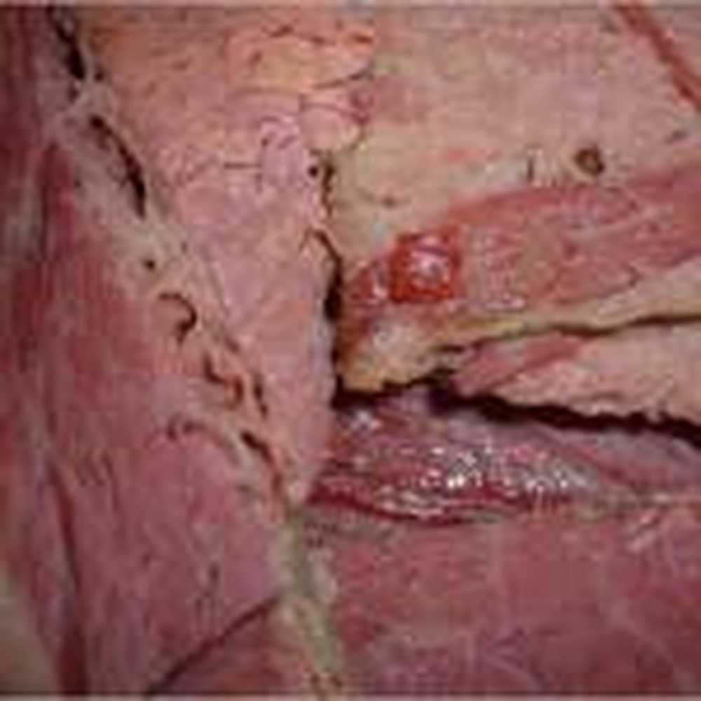 Cârnați antrax și carne de vită corn contaminate? / Știri despre sănătate