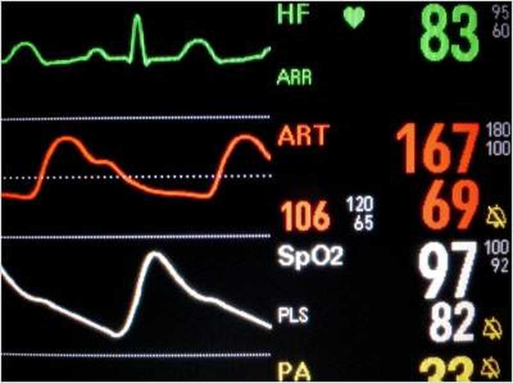 Médecine gériatrique moderne avec ECG du matelas / Nouvelles sur la santé