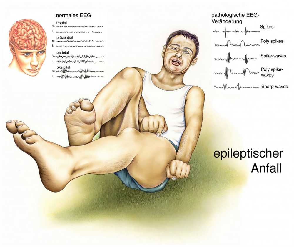 Muscle twitching - muscle twitching