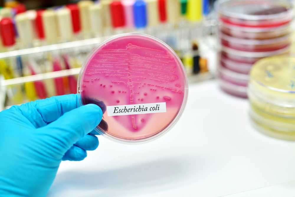 Nieuwe behandelingsopties tegen antibioticaresistente bacteriën ontdekt / Gezondheid nieuws