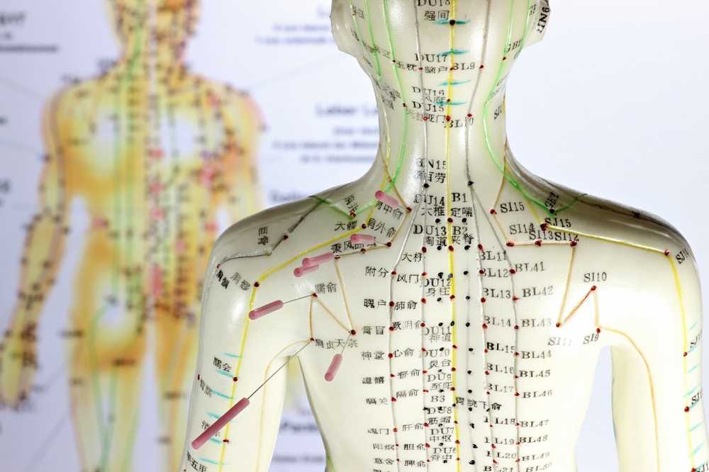 Noua acupunctura de studiu ajuta pacientii cu fibromialgie impotriva durerii cronice / Știri despre sănătate