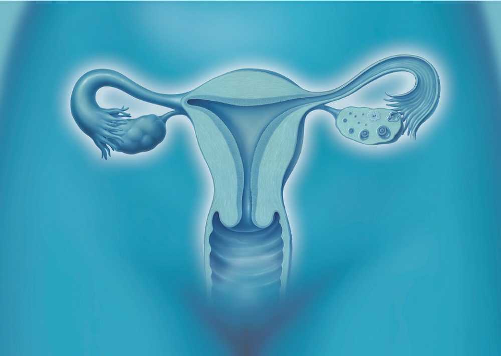 New study freezing of ovarian tissue is safe