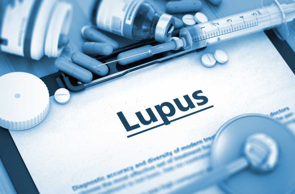 New treatment approach for the autoimmune disease Lupus