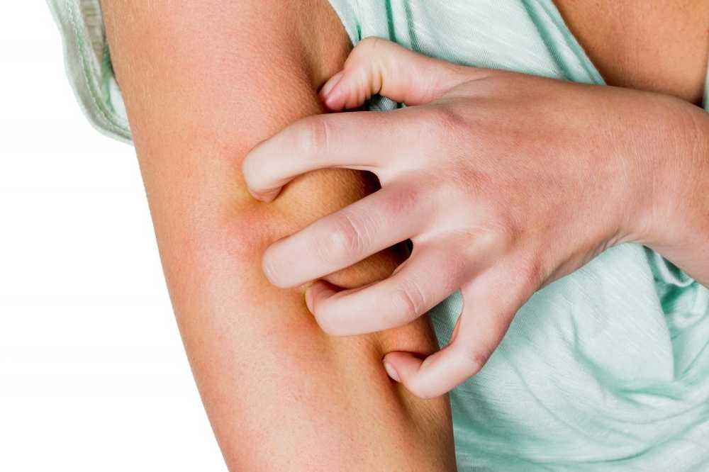 Lo mejor es restringir la dermatitis atópica más claramente. / Noticias de salud