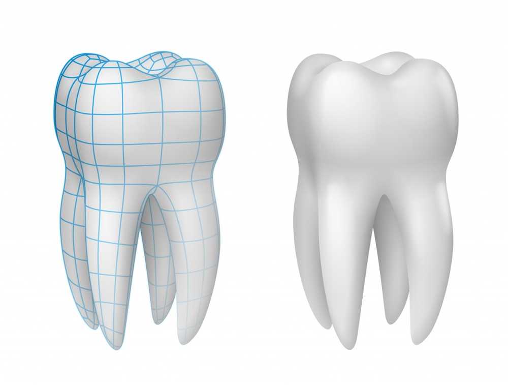 Pacienții din orașe sunt mai predispuși să pună în aplicare coroane dentare / Știri despre sănătate