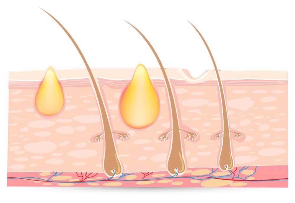 Pimple på rumpan / symptom