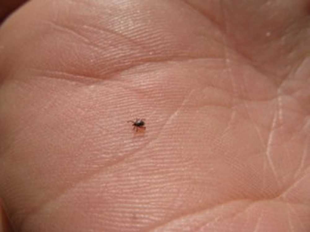 Advice Safely remove crawling ticks with adhesive tape / Health News