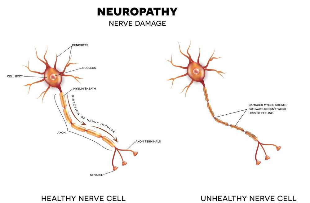 To turn pain into tingling with electrostimulation? / Health News