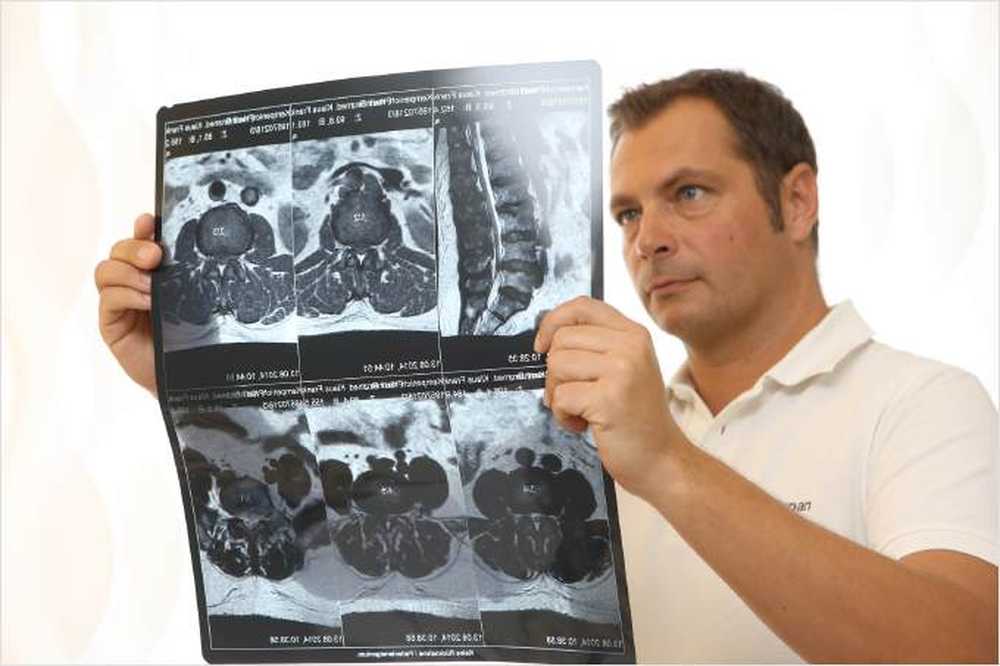 Echilibrează bine operațiile de stenoză a canalului vertebral / Știri despre sănătate