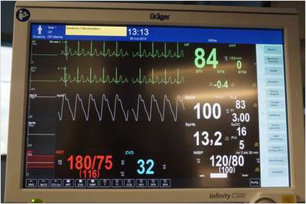 Stabbing in the chest More special emergency rooms / Health News