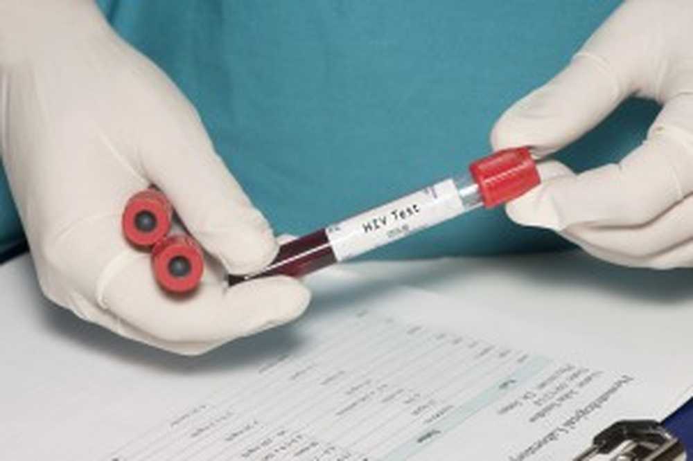 Rising numbers of HIV-infected people in Russia is becoming a threat / Health News