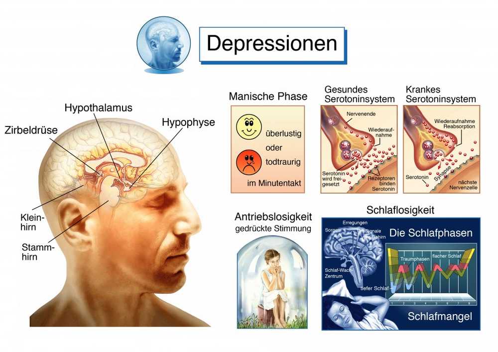 Studie depression presser ned hippocampus?