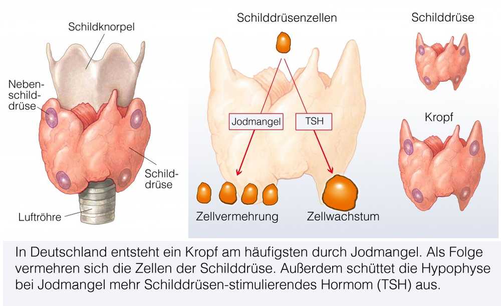 Onder Powers? Slechts een op de vier huishoudens gebruikt gejodeerd zout / Gezondheid nieuws