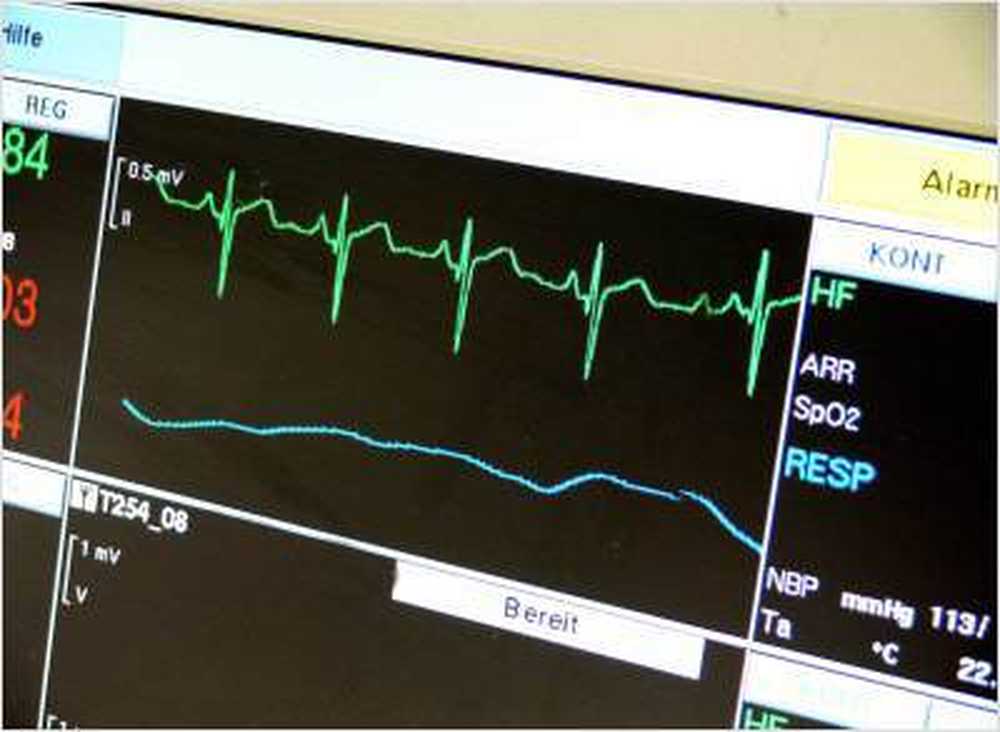 Cure atrieflimmer ved å miste vekt / Helse Nyheter