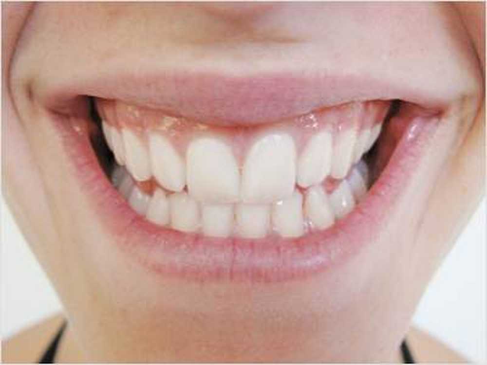 What really helps against teeth grinding / Health News