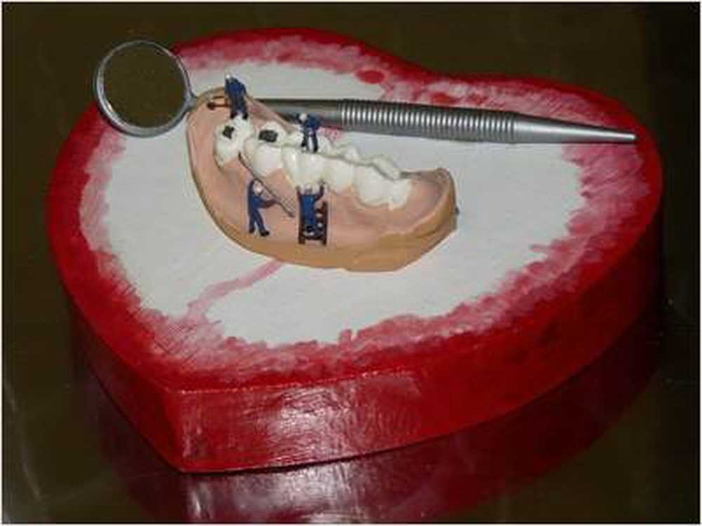 White & gapless veneers generates dream teeth? / Health News