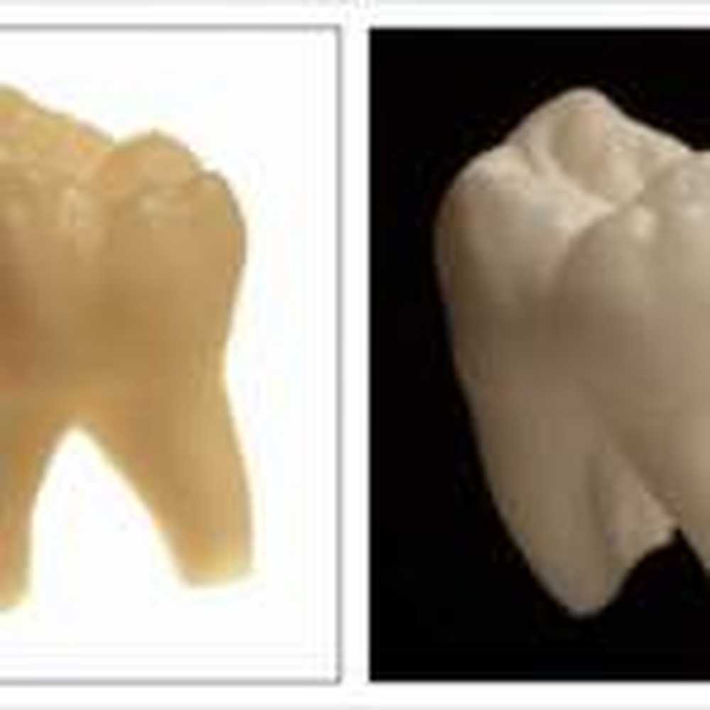 Dentures Speciellt be om alternativ