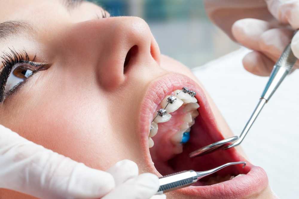 Bretelle dentista utile anche per gli adulti