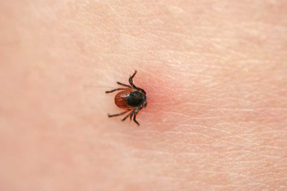 tick bite