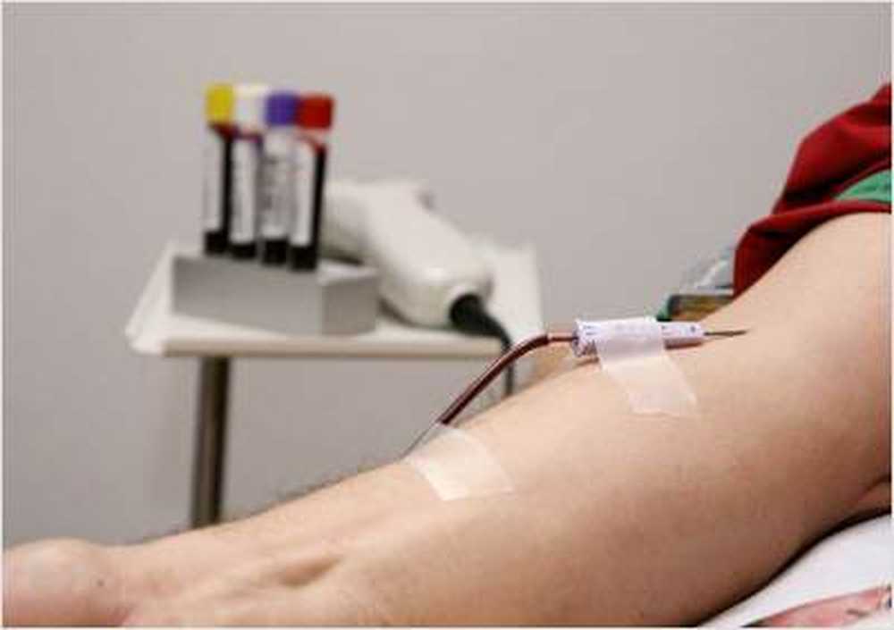 Tien kinderen besmet met HIV na bloedtransfusie / Gezondheid nieuws