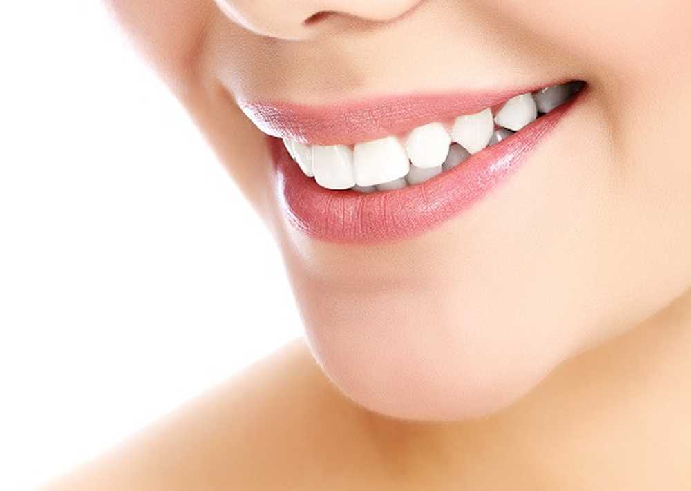 Rendi i denti più luminosi. Ecco come funziona il fulmine / Notizie di salute