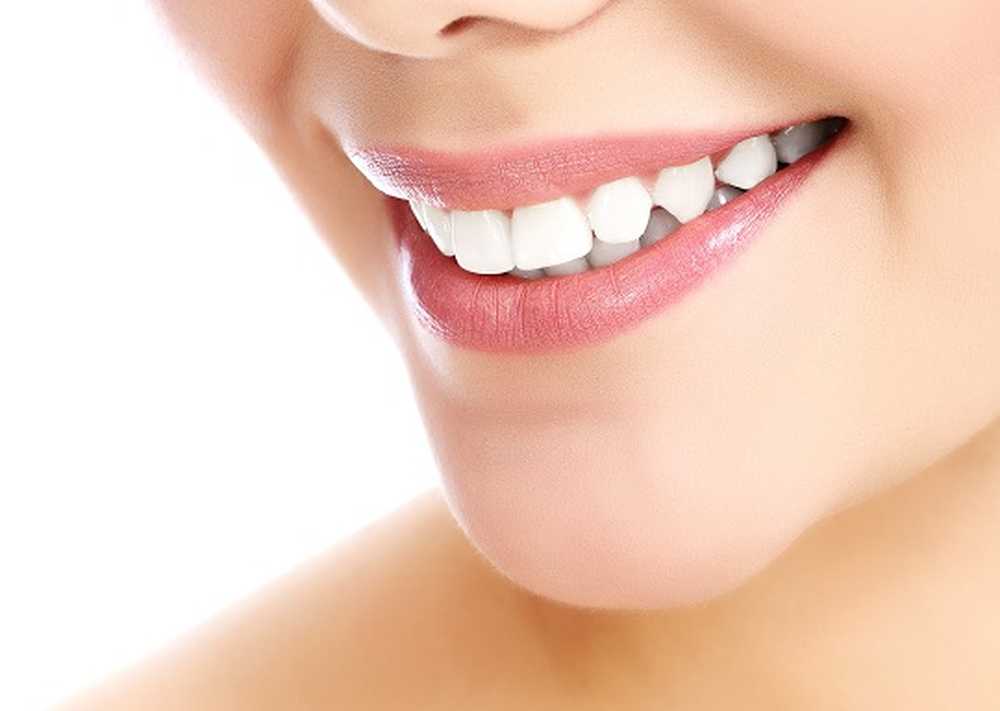 Rendi i denti più luminosi. Ecco come funziona il fulmine