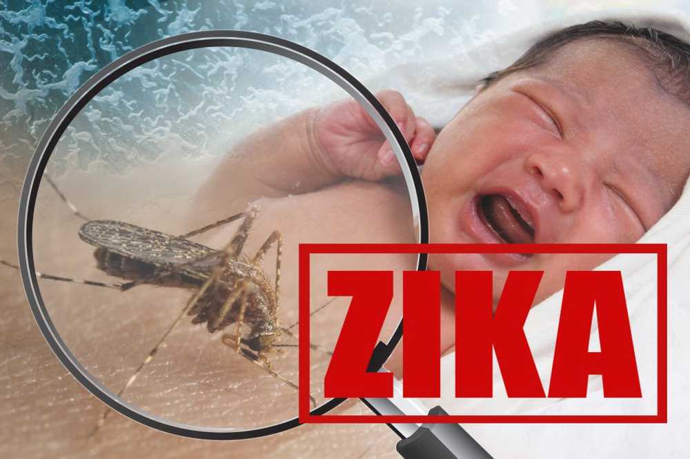 Zika-virusonderzoekers wijzen op de verbinding van de infectie met schedelmisvormingen / Gezondheid nieuws