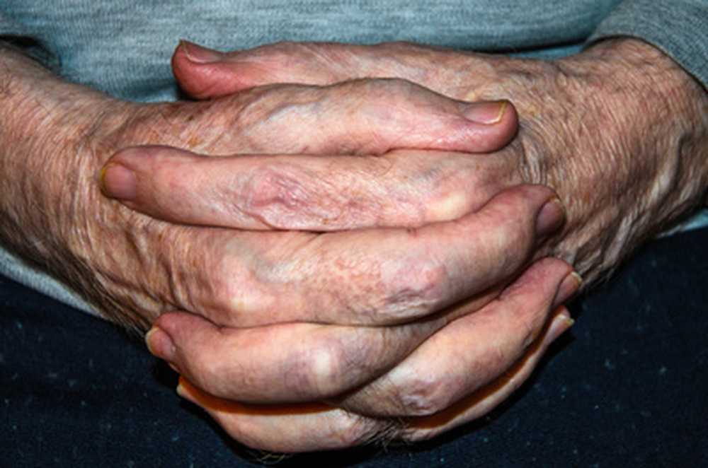 Skakande händer / händer skakning / symptom