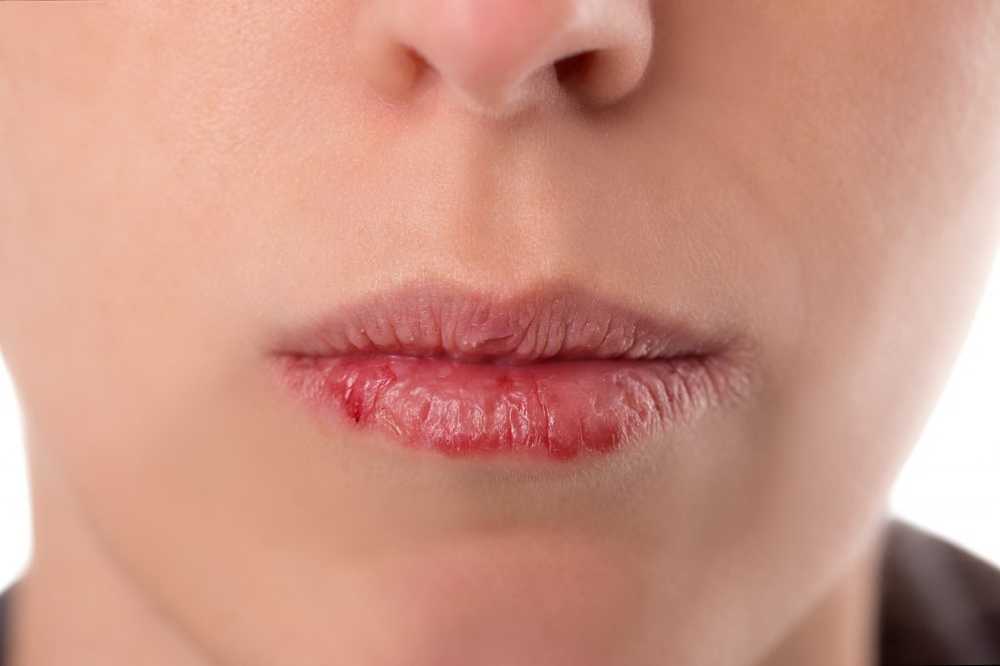 Bonbons sans sucre pour la bouche sèche