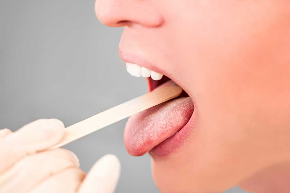 Tongue tongue covered / symptoms