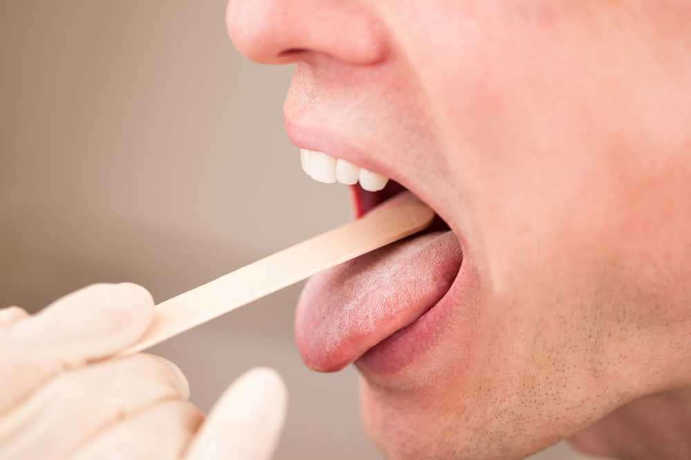 Tongue fungus causes and treatment